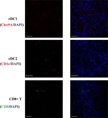 Conventional Type 1 Dendritic Cells (cDC1) in Human Kidney Diseases: Clinico-Pathological Correlations